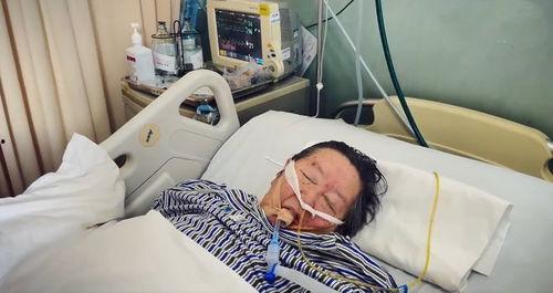 全身插管视频,技术精湛，生命守护