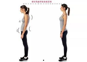 驼背能当明星吗,揭秘驼背如何成就明星之路